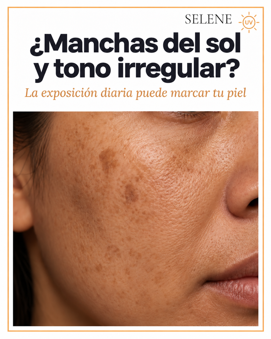 Selene® Bloqueador LINDONIA Glow Coreano SPF50